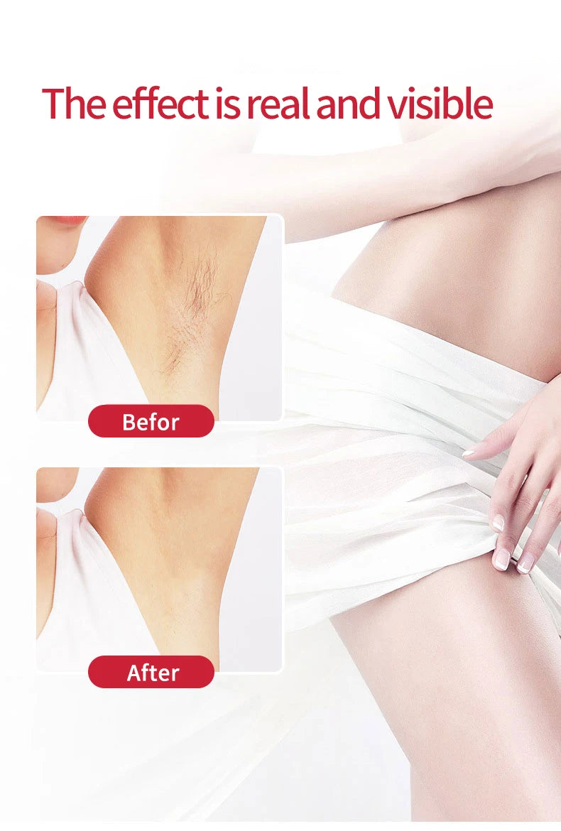 Women's Hair Remover Epilator